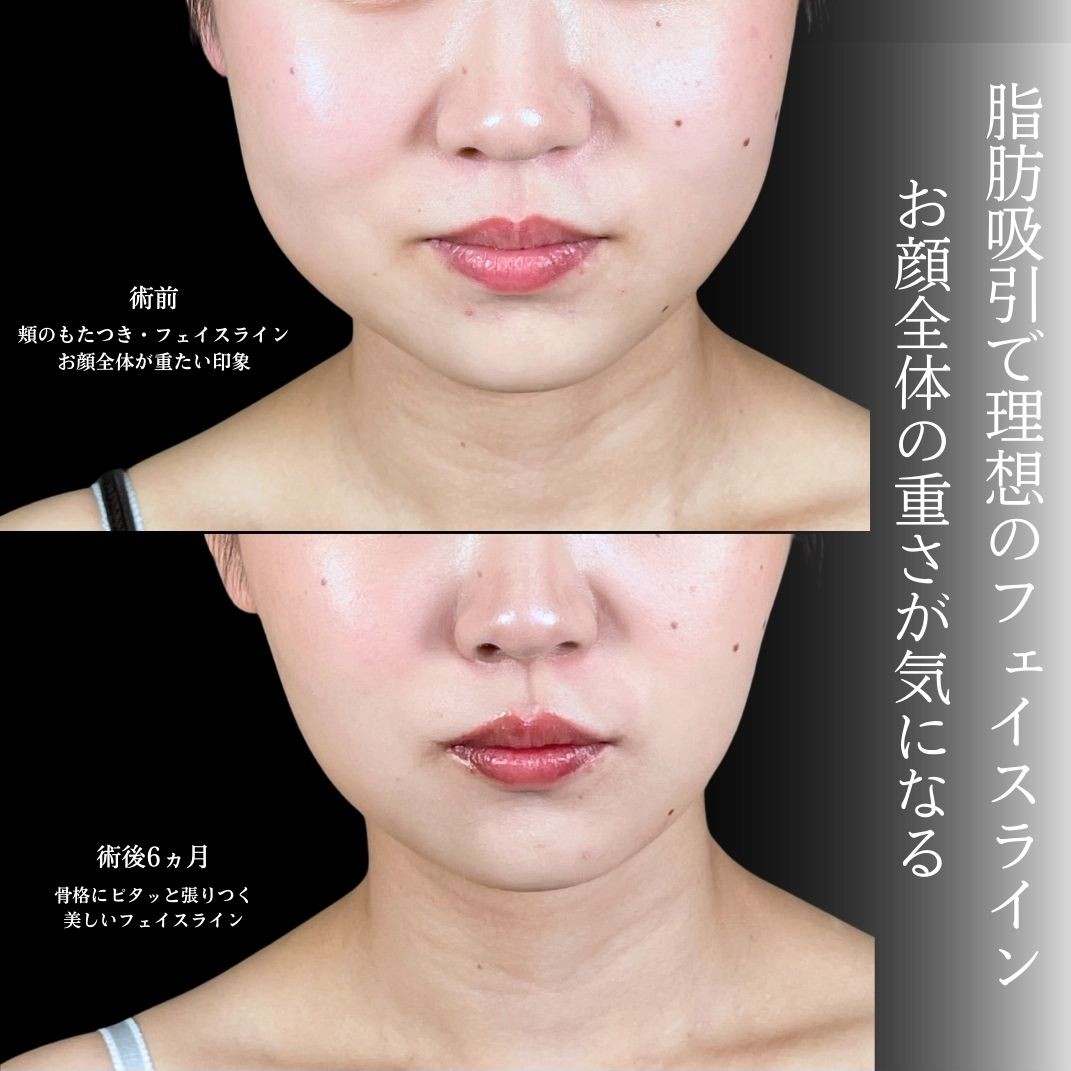 No.19707の症例写真1