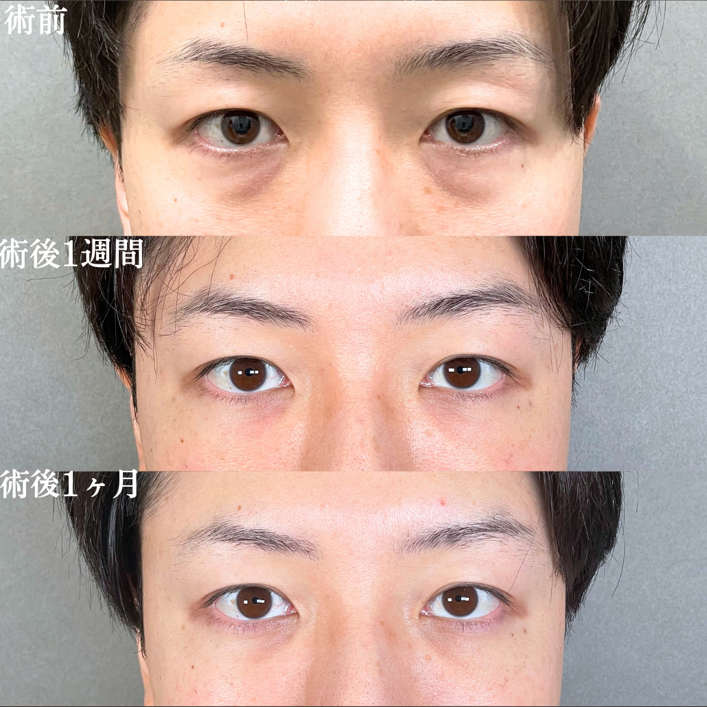 No.19481の症例写真1