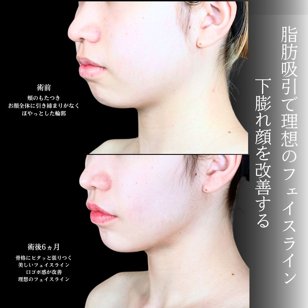 No.19751の症例写真1