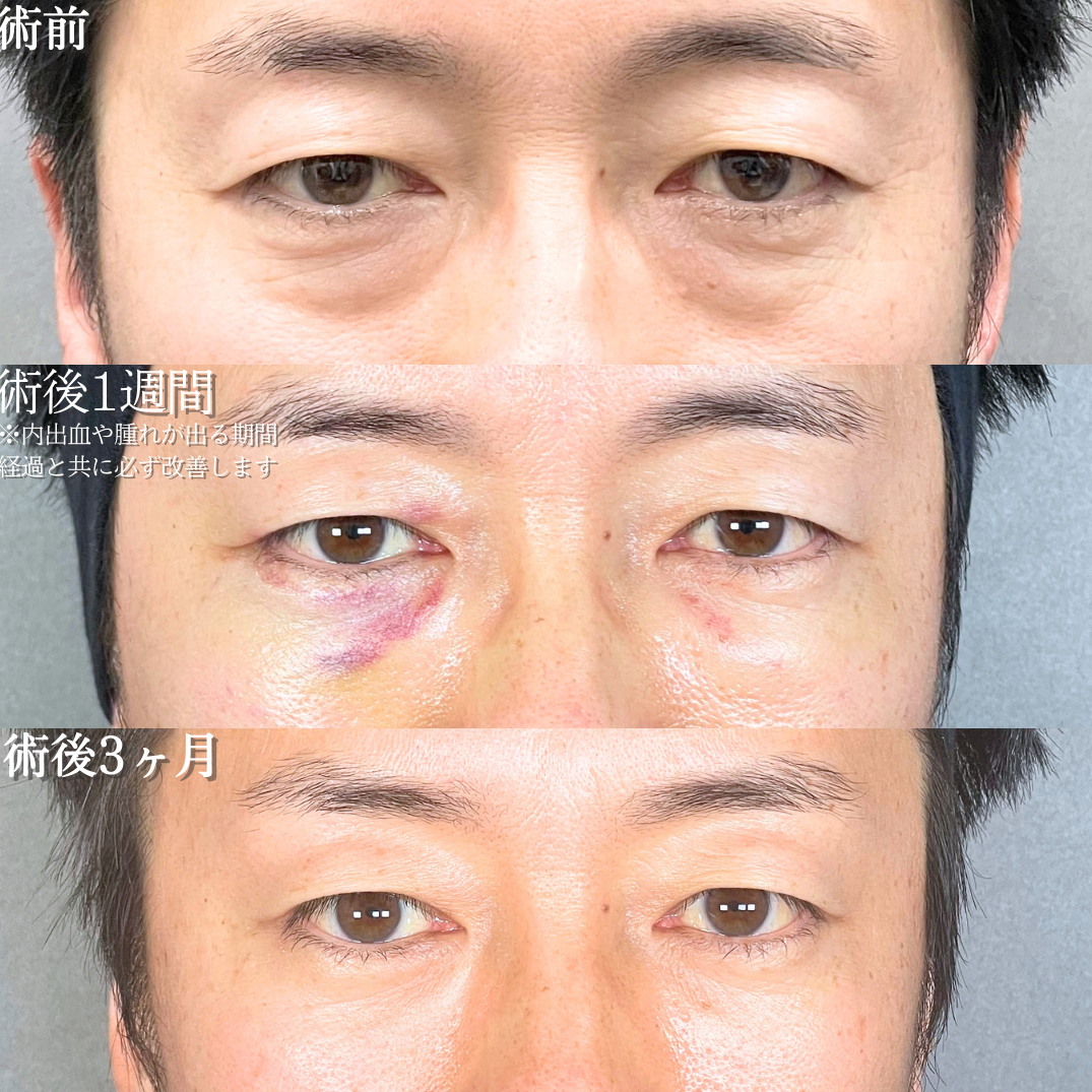 No.19506の症例写真1