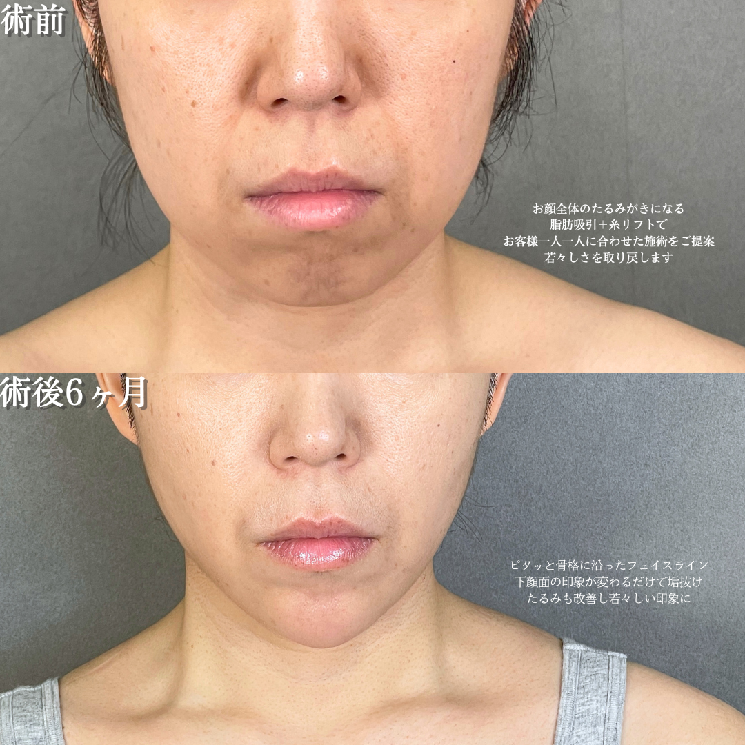 No.19602の症例写真1