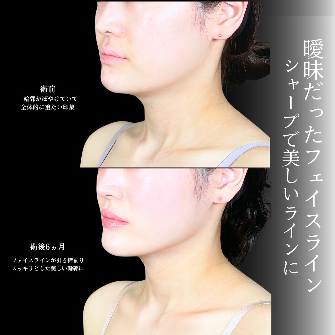 No.19609の症例写真1