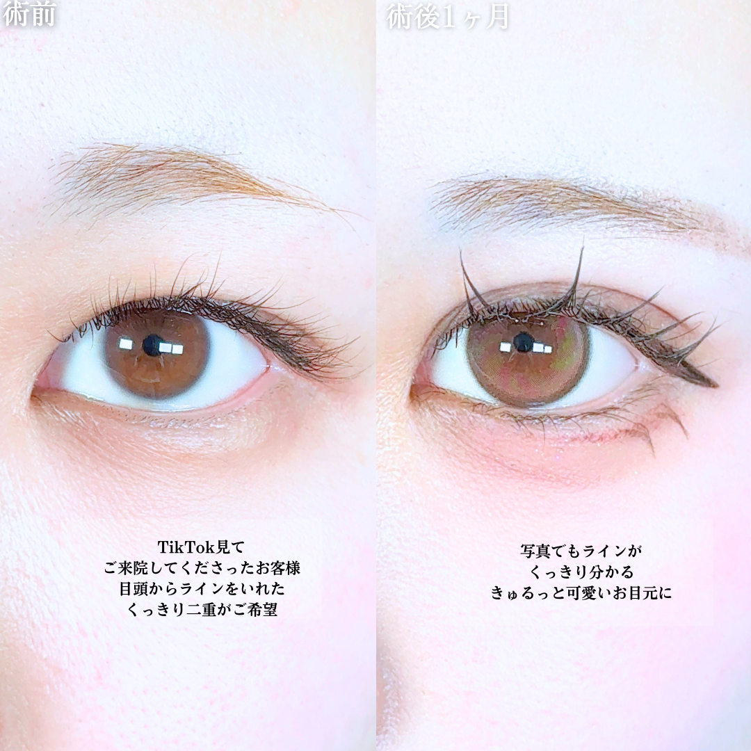 No.19616の症例写真1