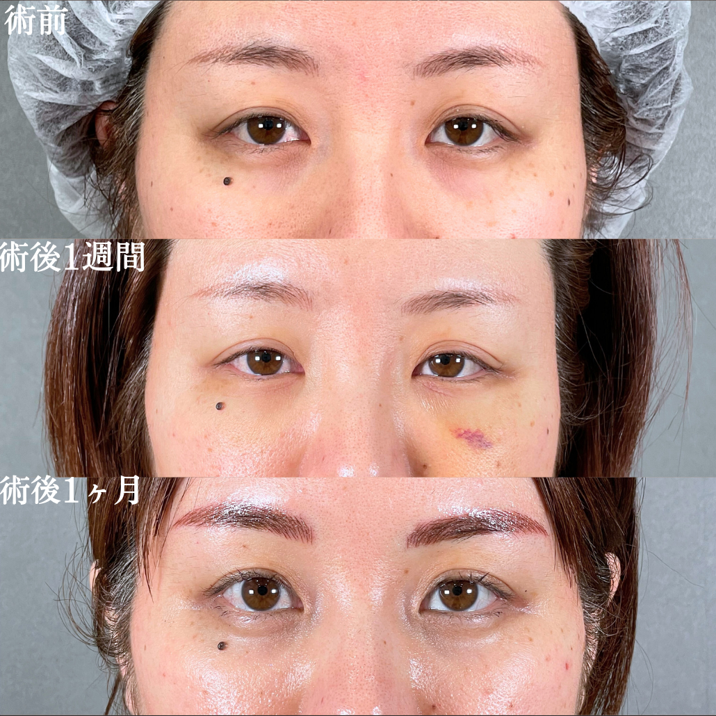 No.19650の症例写真1