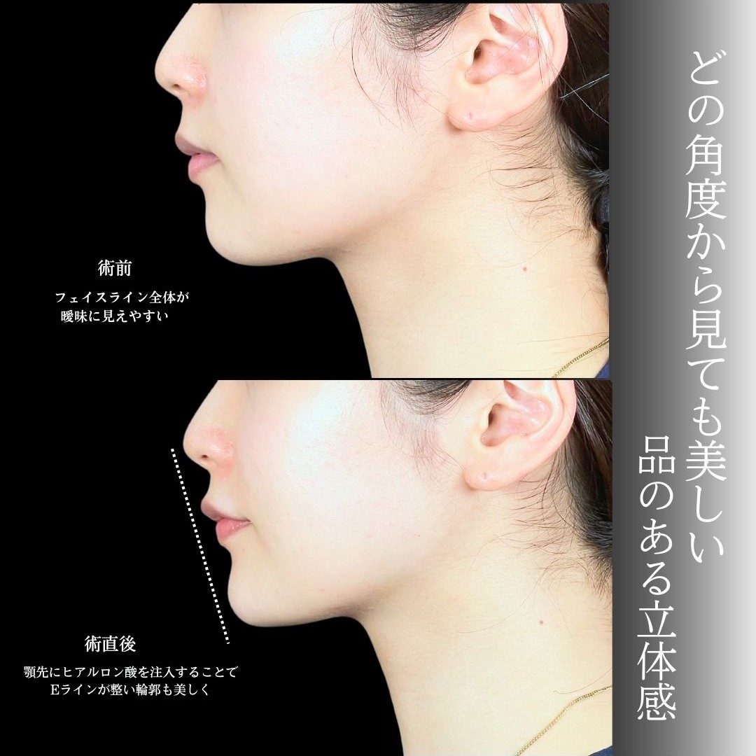 No.19382の症例写真1