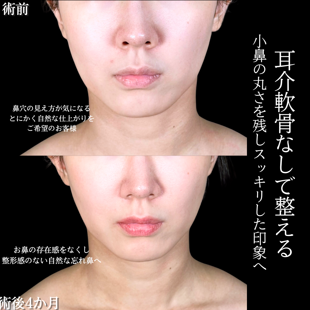 No.19403の症例写真1