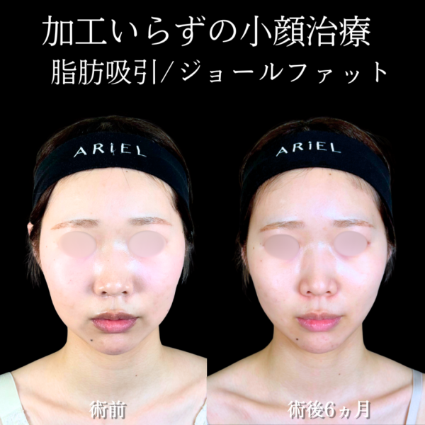 No.19504の症例写真