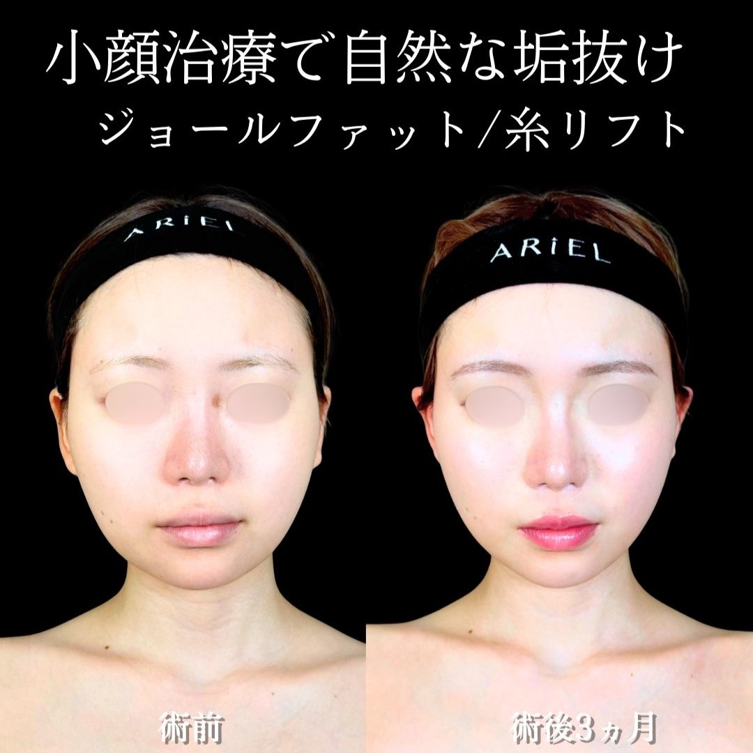 No.19468の症例写真