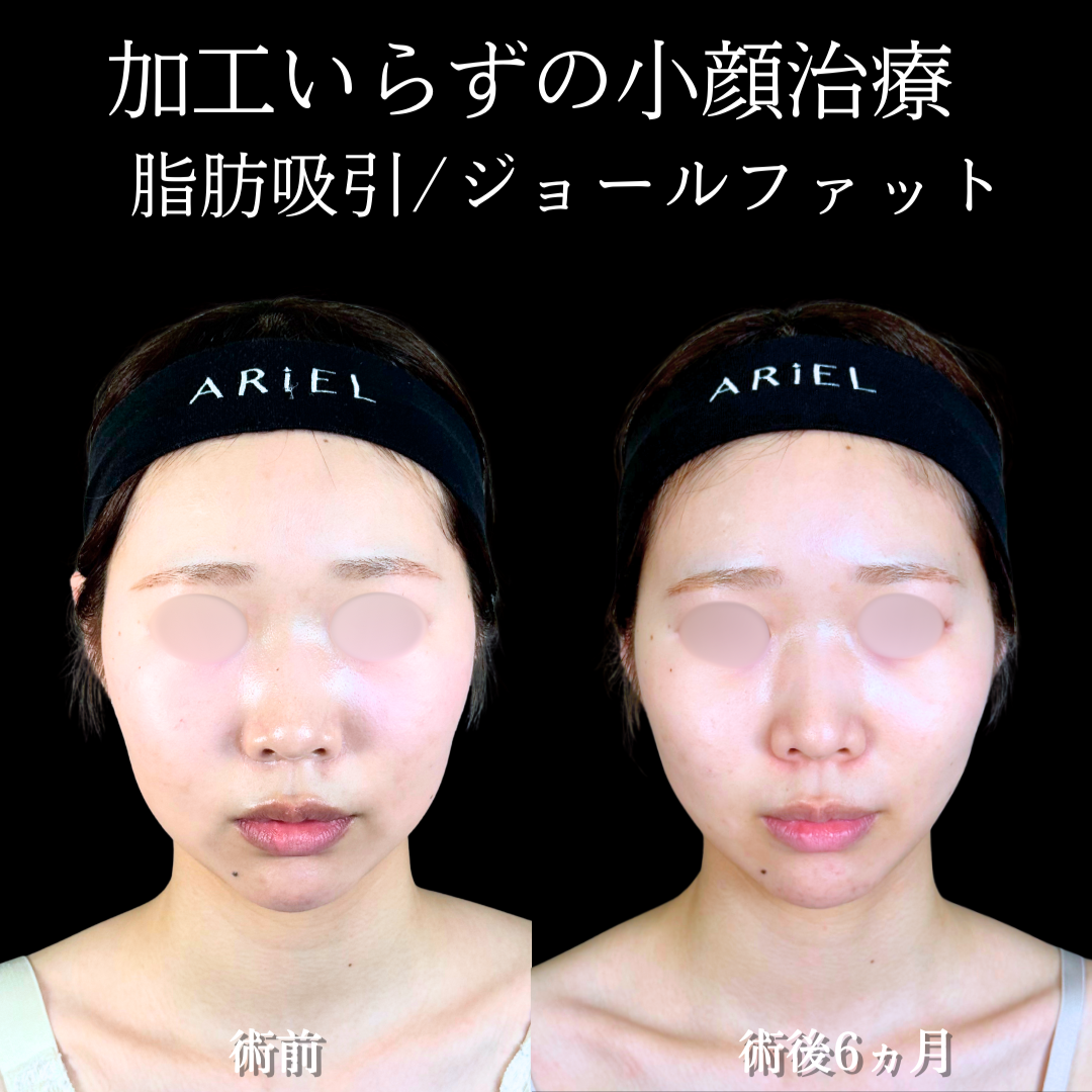 No.19504の症例写真