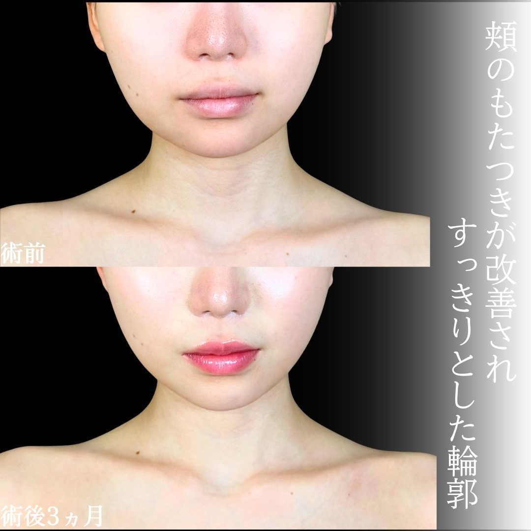 No.19468の症例写真1