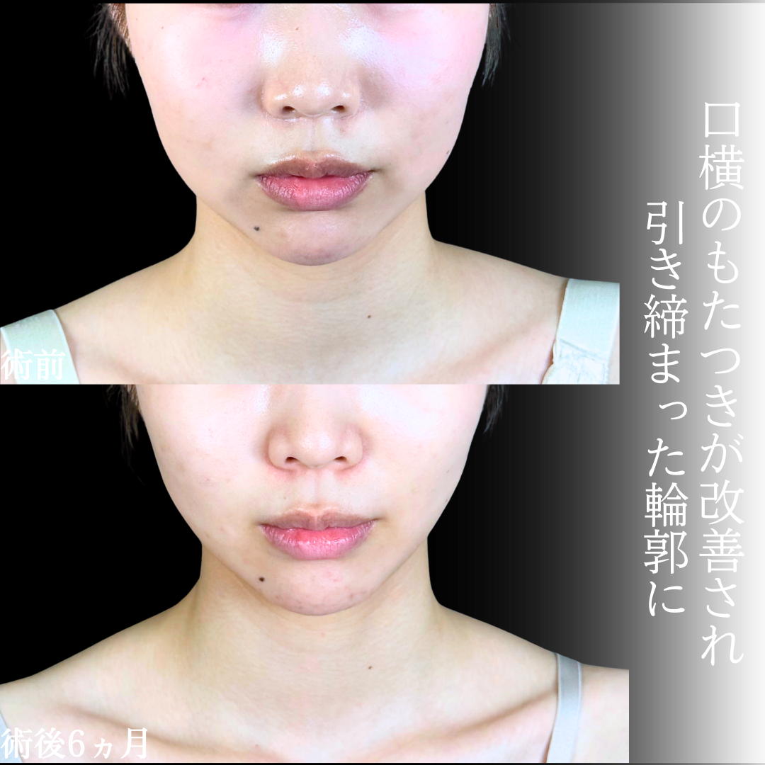 No.19504の症例写真1