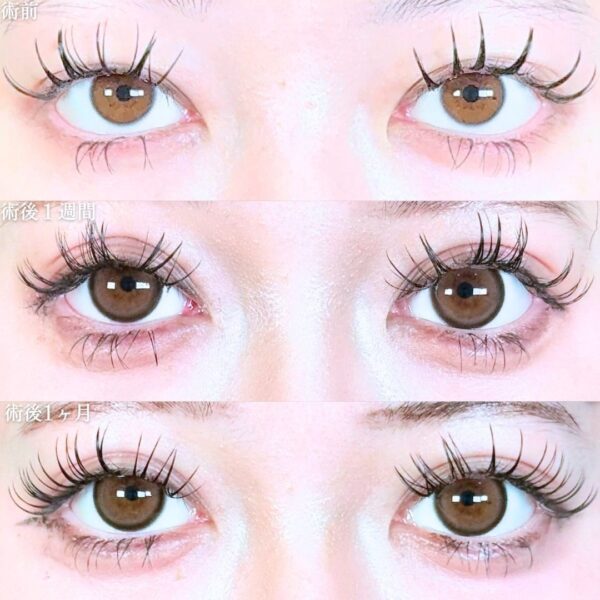 No.19418の症例写真