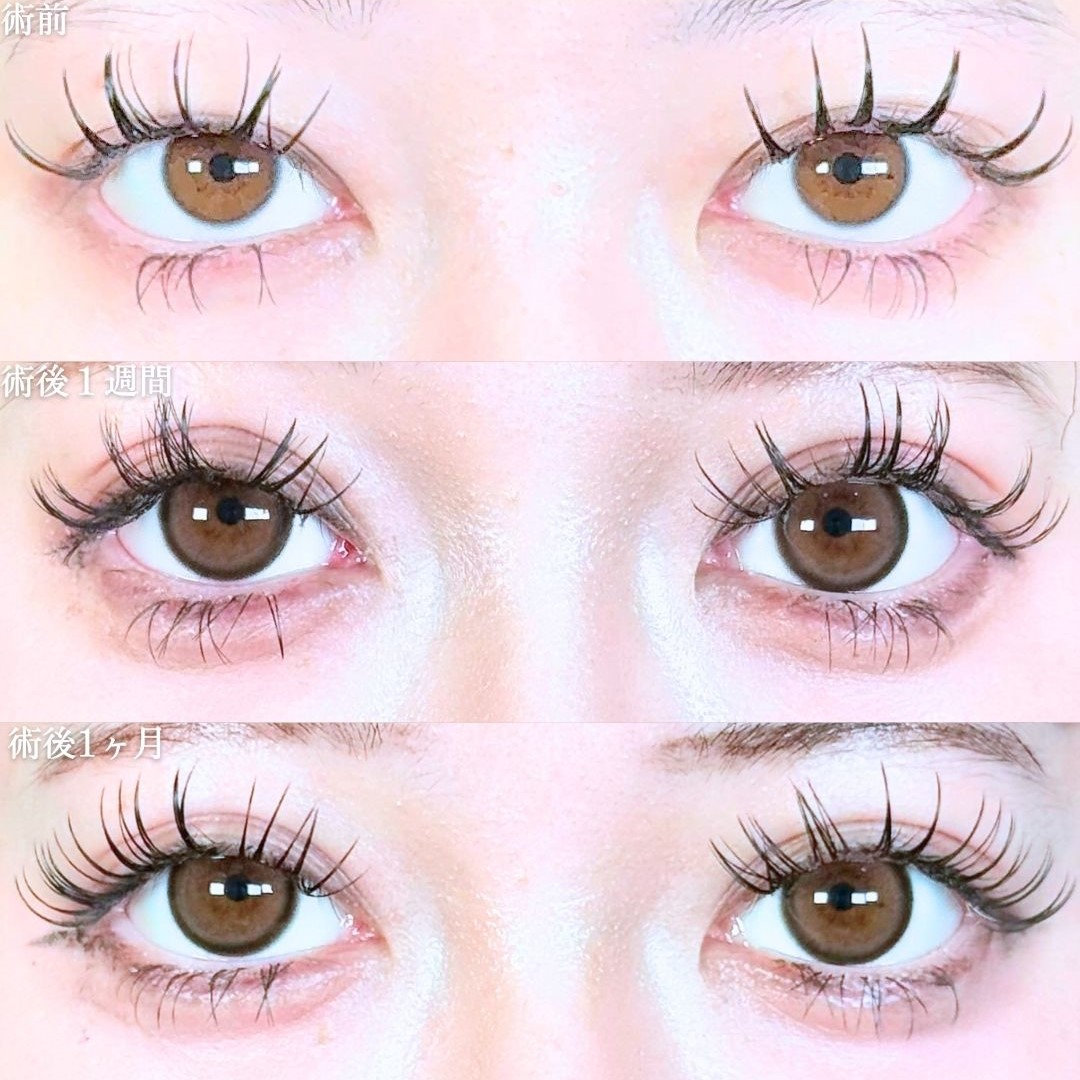 No.19418の症例写真