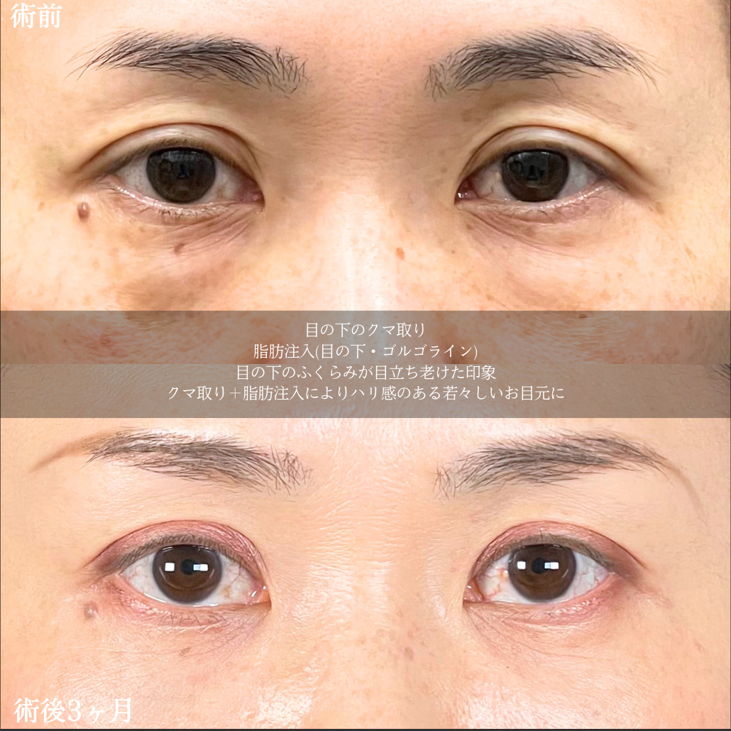 No.19410の症例写真2