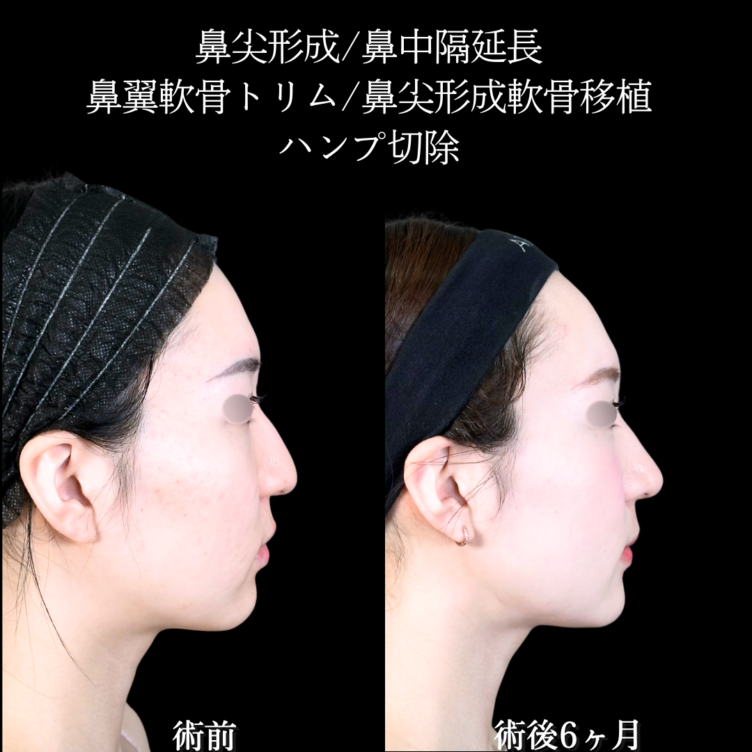 No.19720の症例写真1