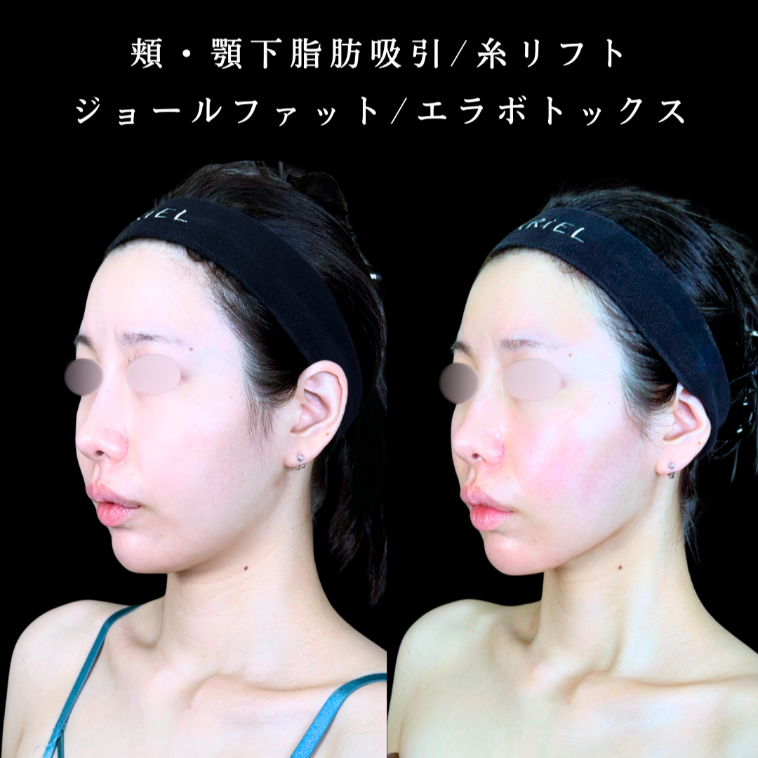 No.19743の症例写真2