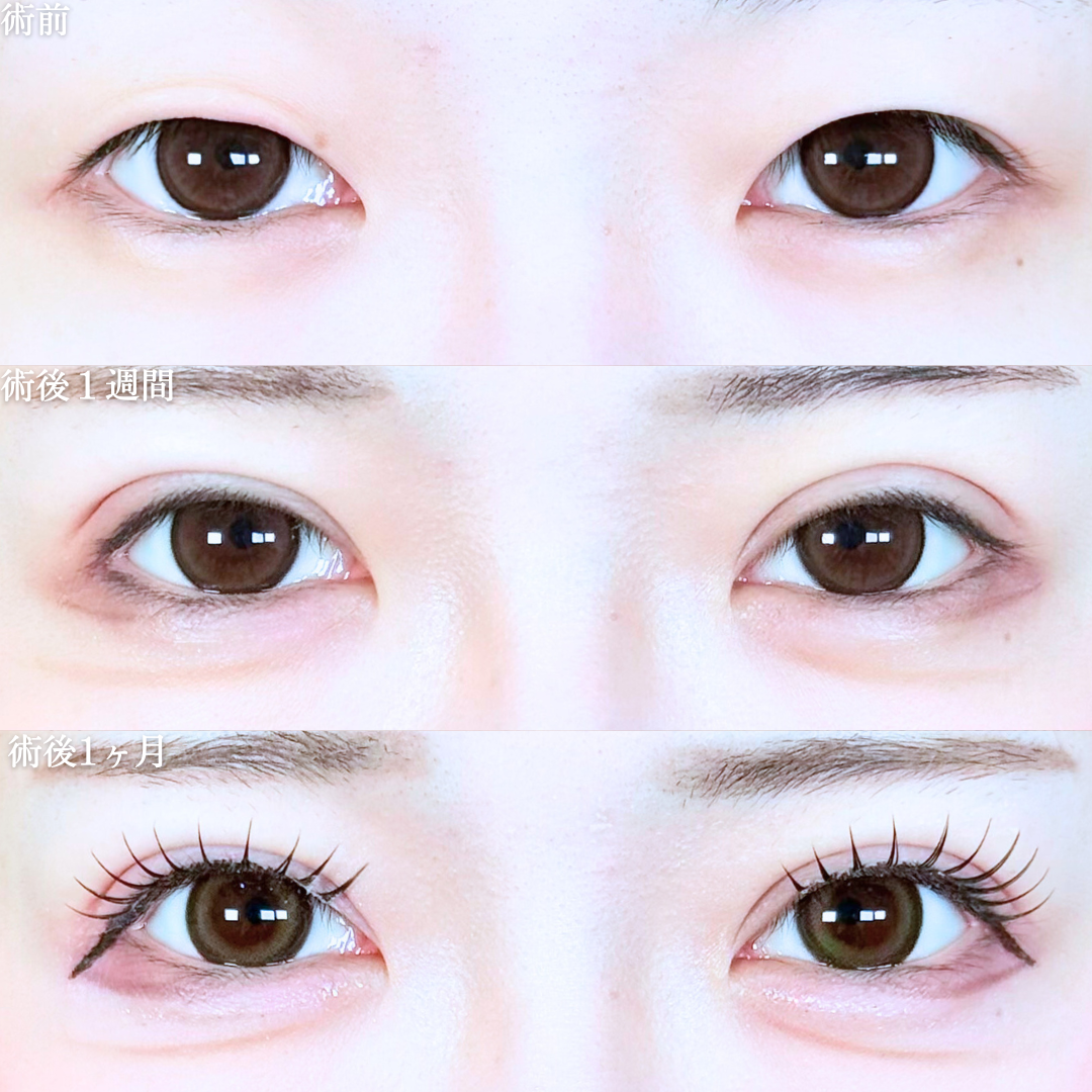 No.19760の症例写真