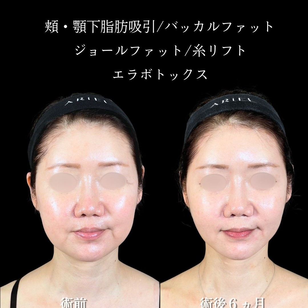 No.19432の症例写真2