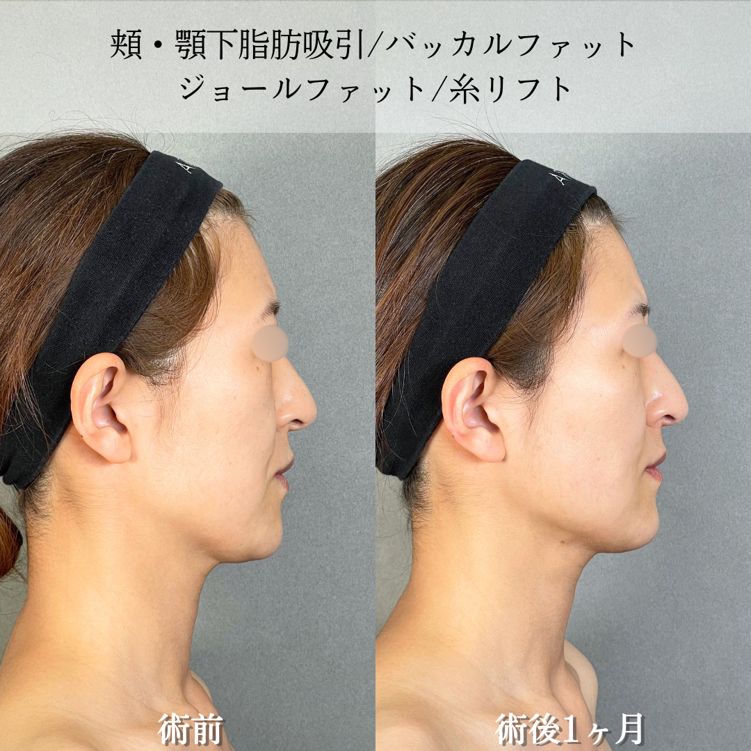 No.19460の症例写真1