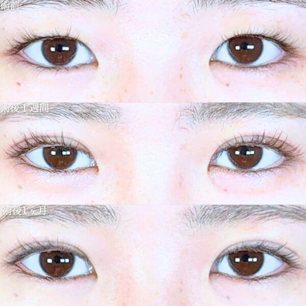 No.19475の症例写真