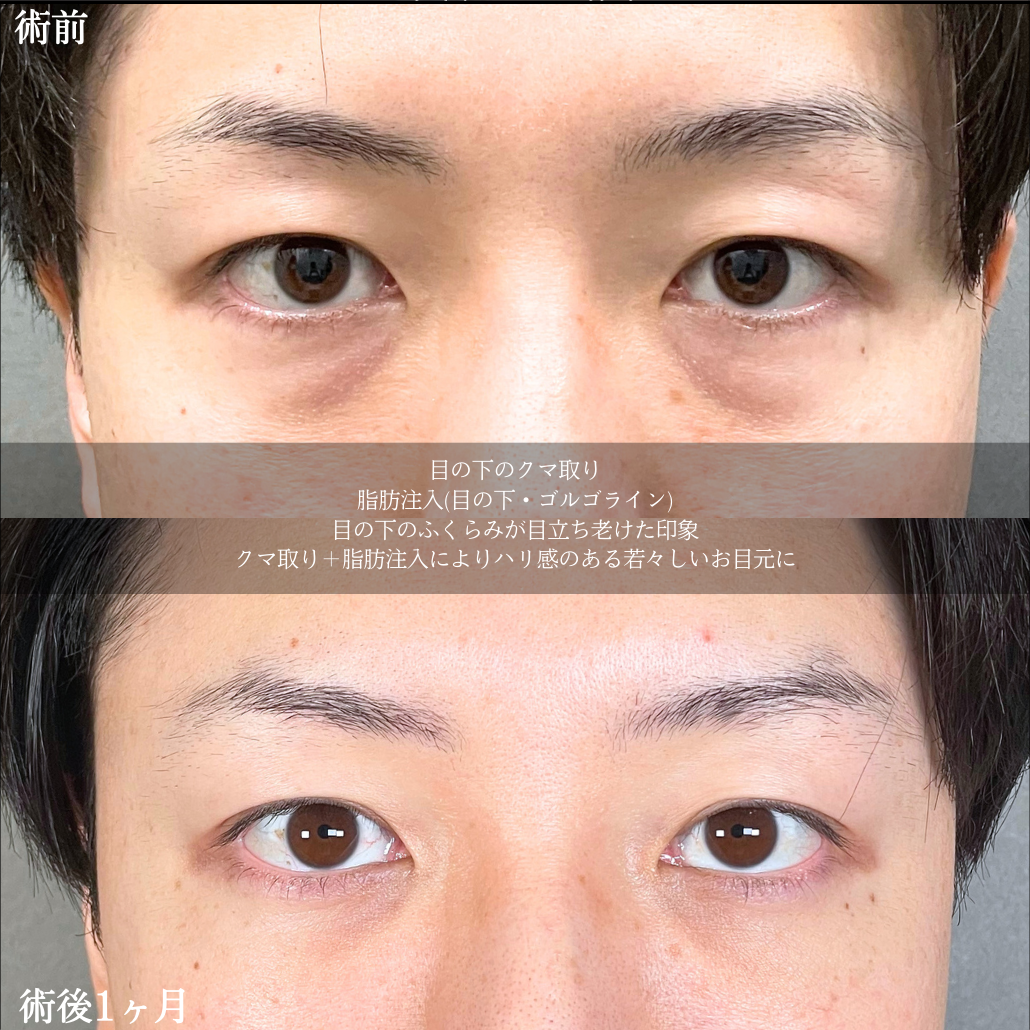 No.19481の症例写真2