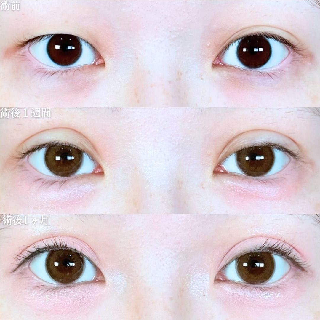 No.19591の症例写真