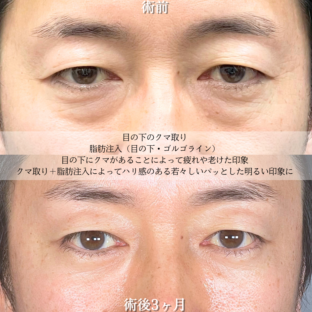 No.19506の症例写真2