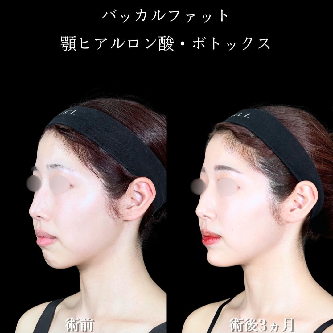 No.19642の症例写真2