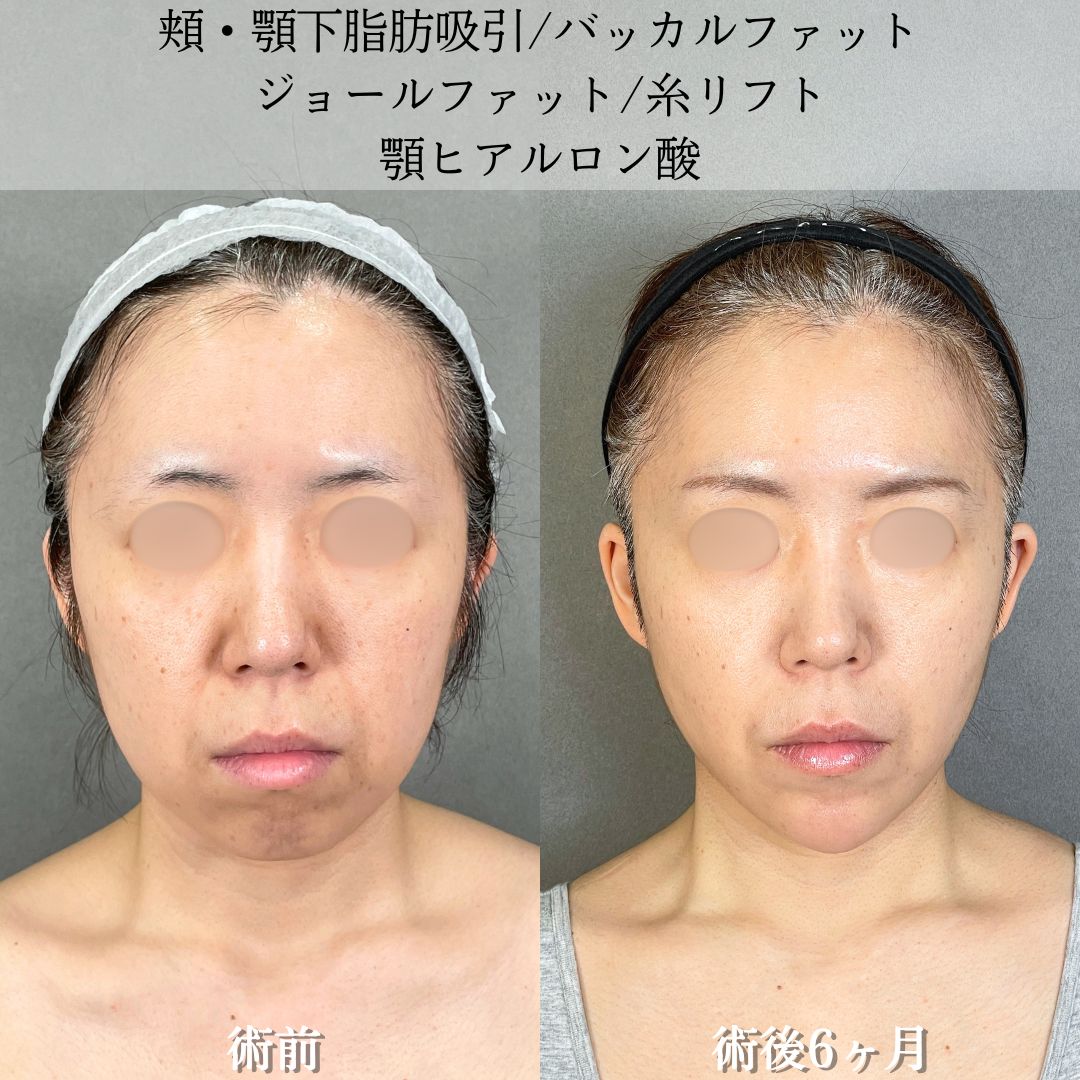 No.19602の症例写真2