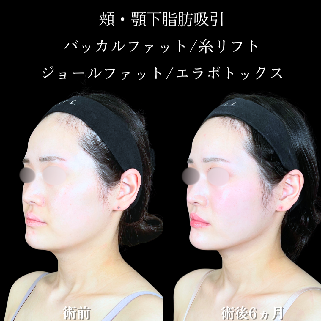 No.19609の症例写真2