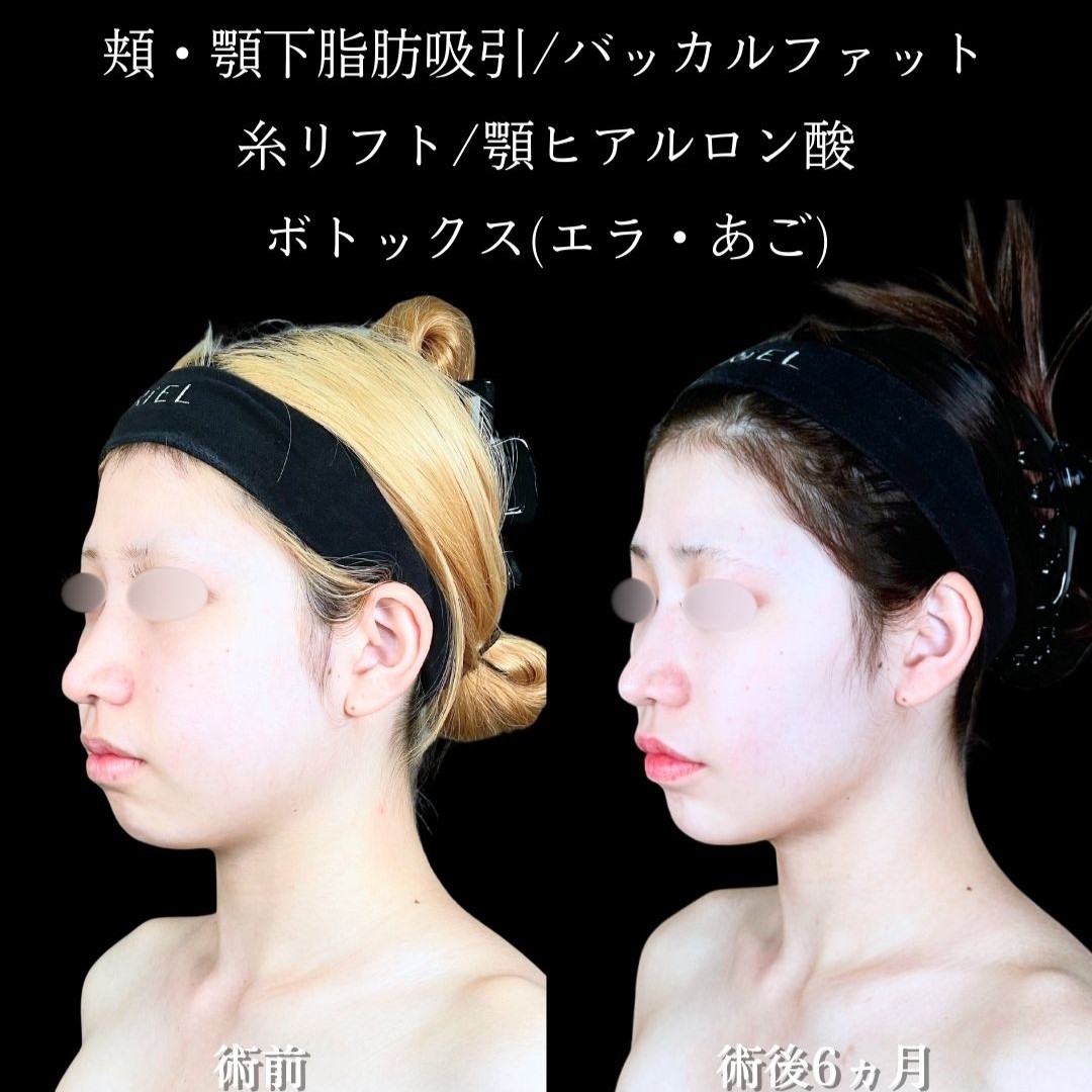 No.19751の症例写真2