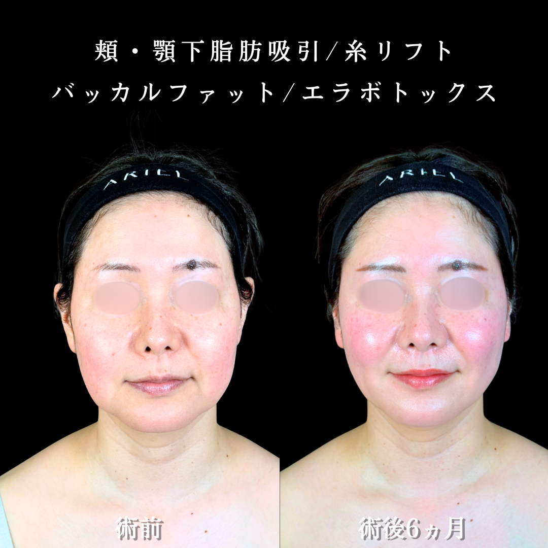 No.19640の症例写真2