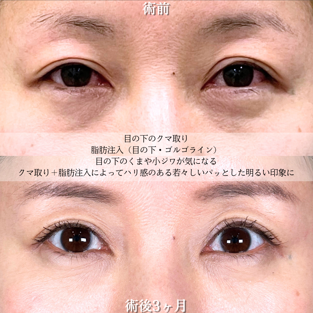 No.19701の症例写真2