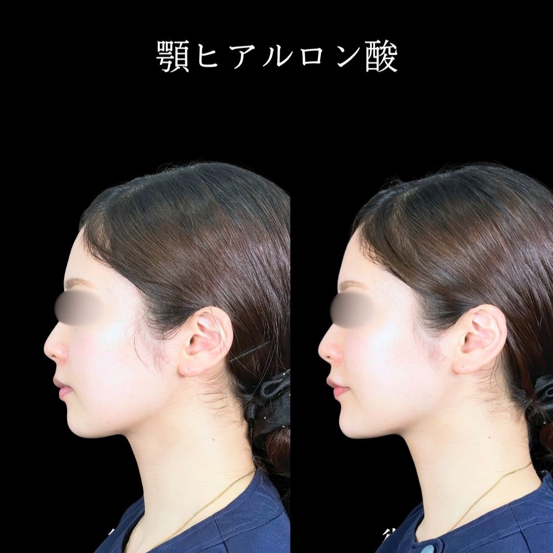 No.19382の症例写真2