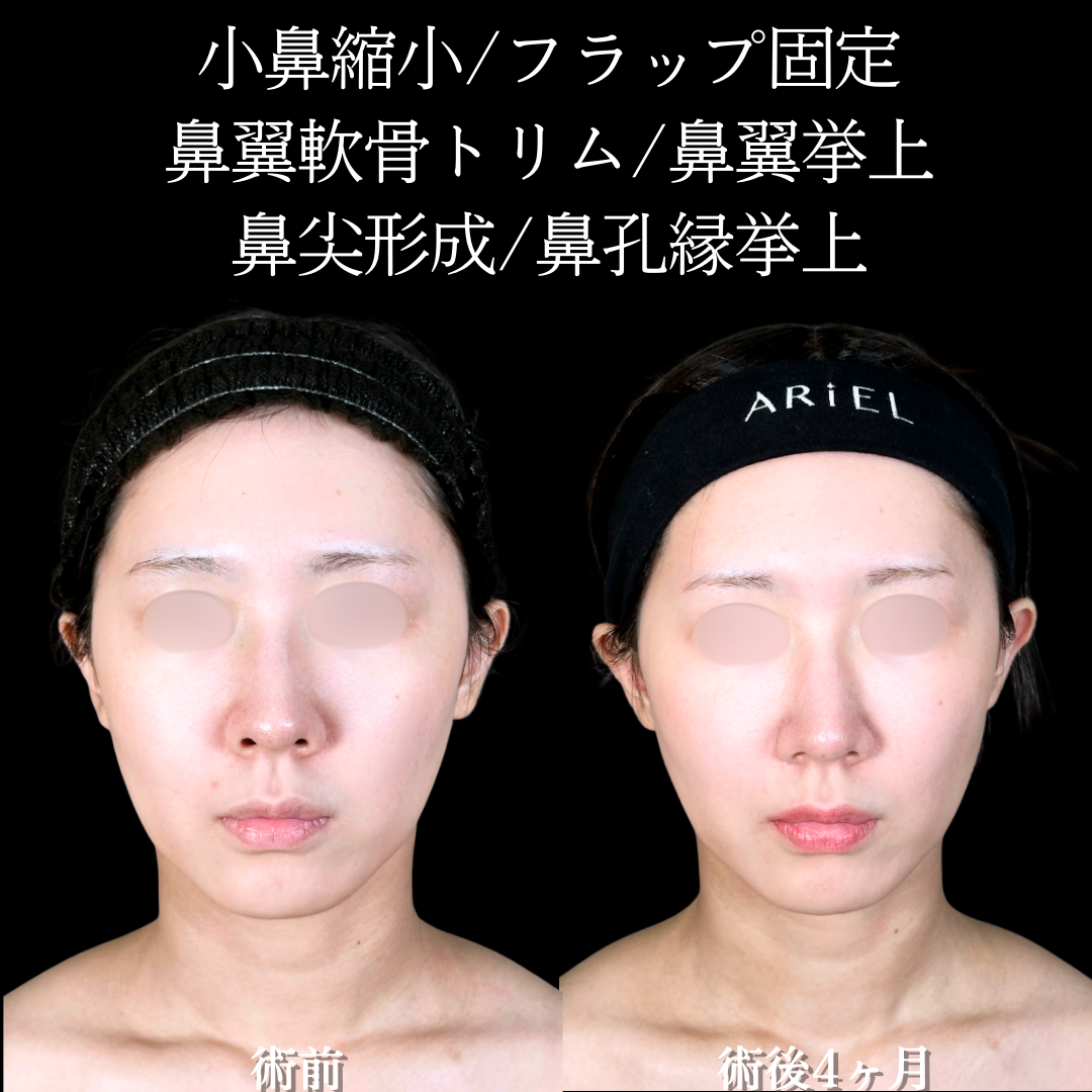 No.19403の症例写真2