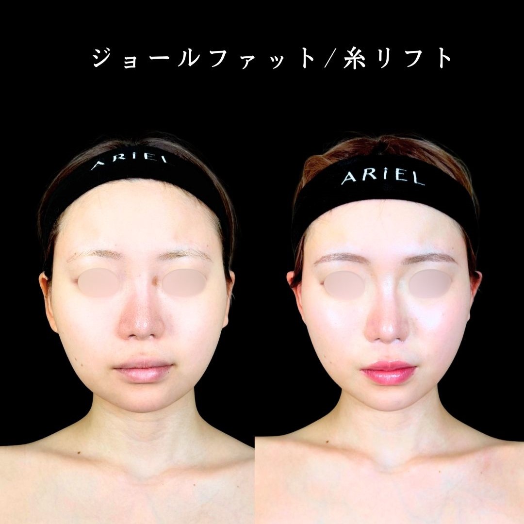 No.19468の症例写真2