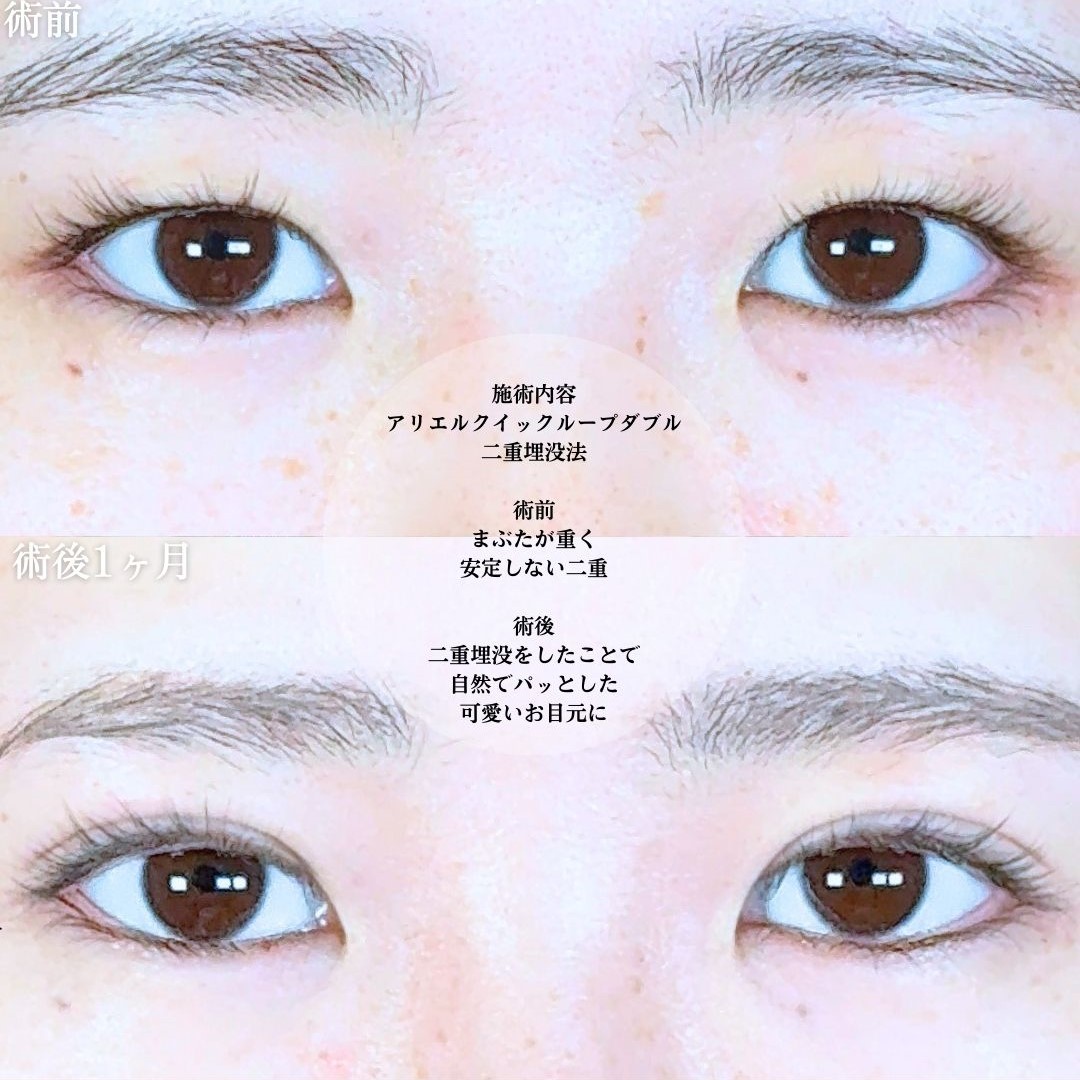 No.19475の症例写真1