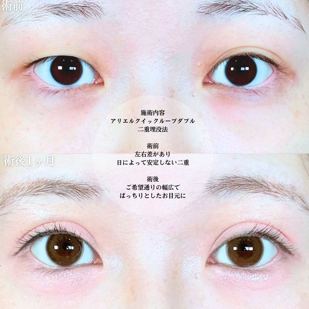 No.19591の症例写真1