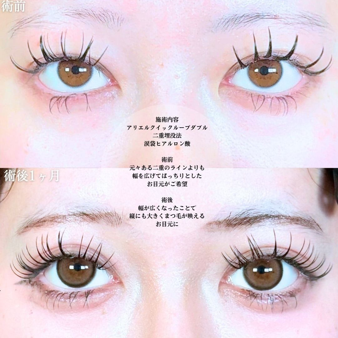 No.19418の症例写真1