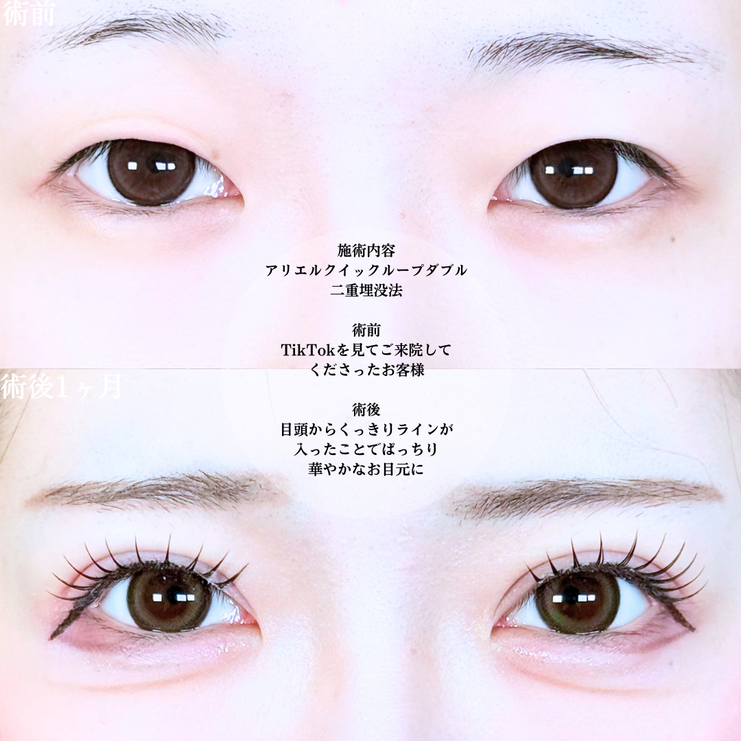 No.19760の症例写真1