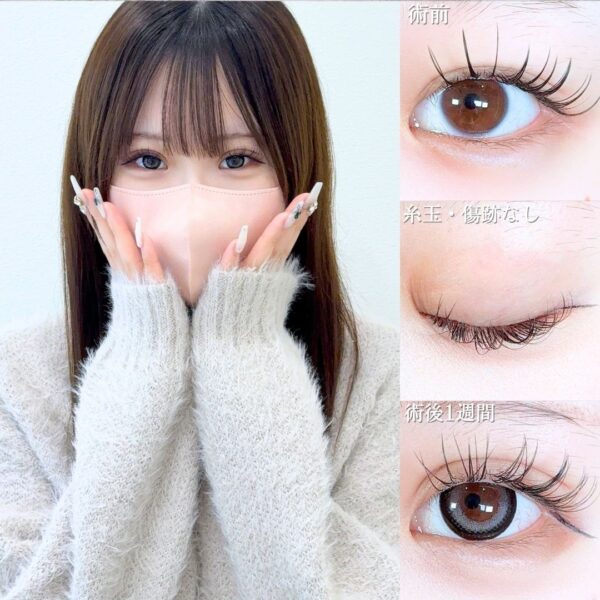 No.19397の症例写真