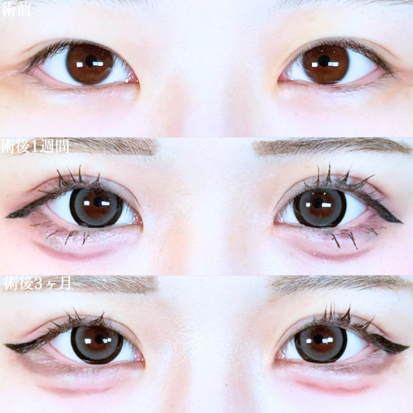 No.19737の症例写真