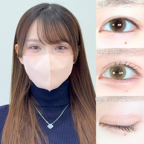 No.19728の症例写真