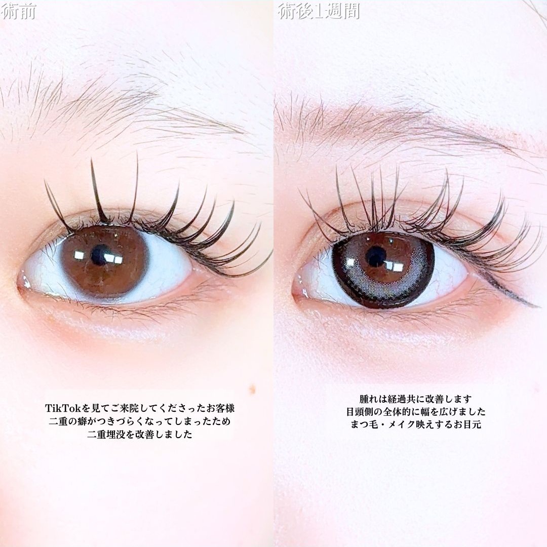 No.19397の症例写真1