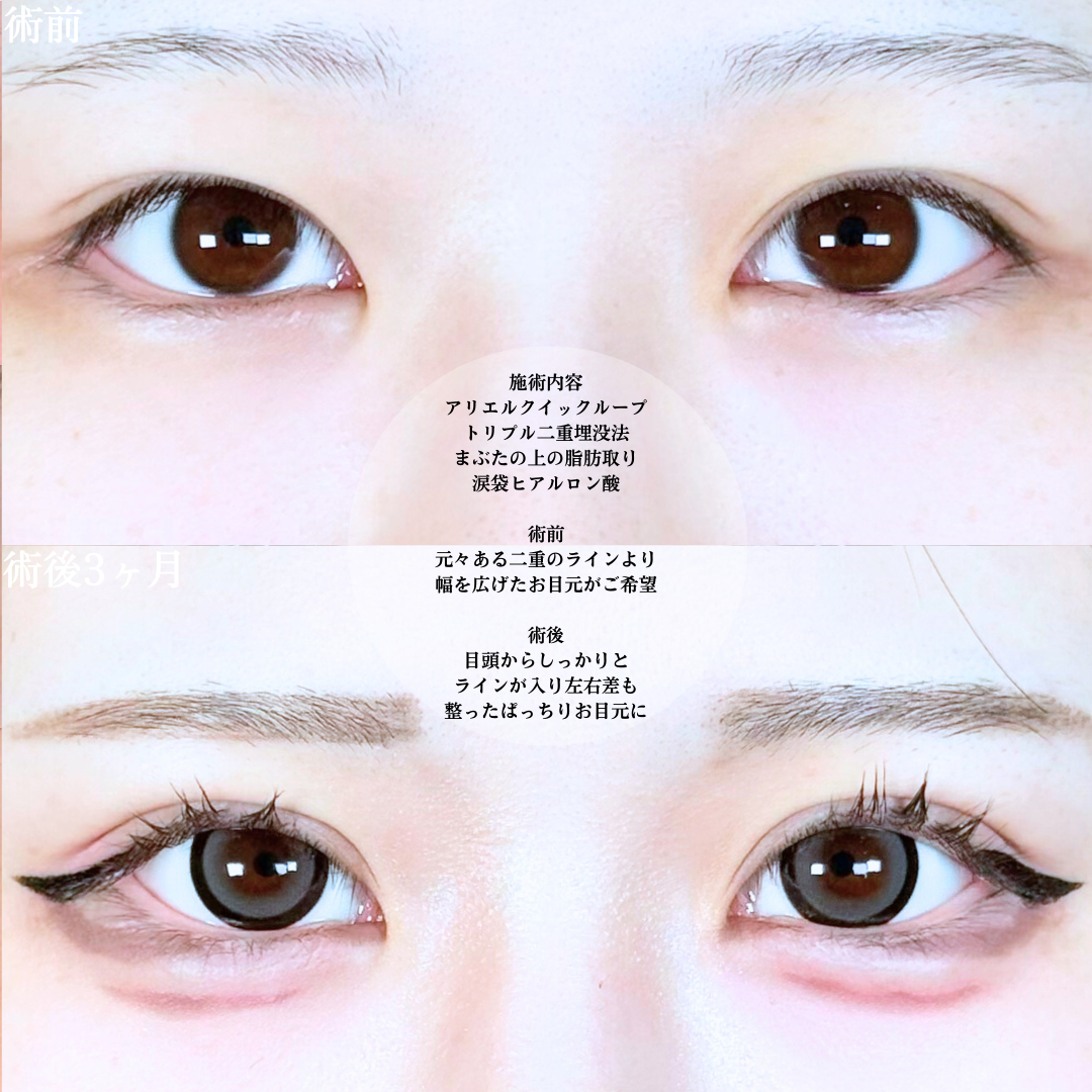 No.19737の症例写真1