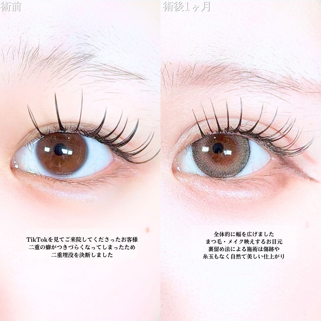 No.19454の症例写真1