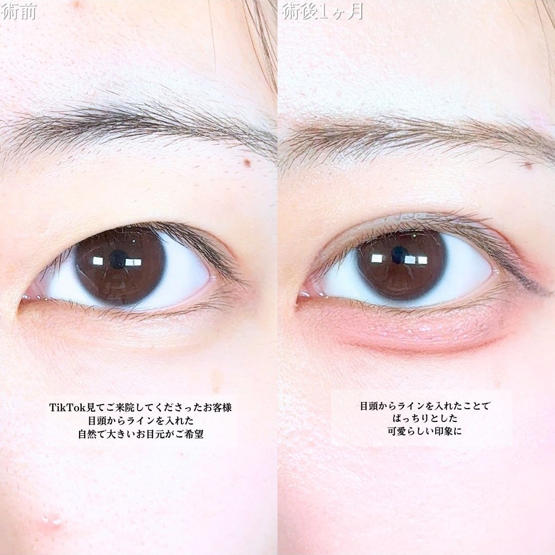 No.19519の症例写真1