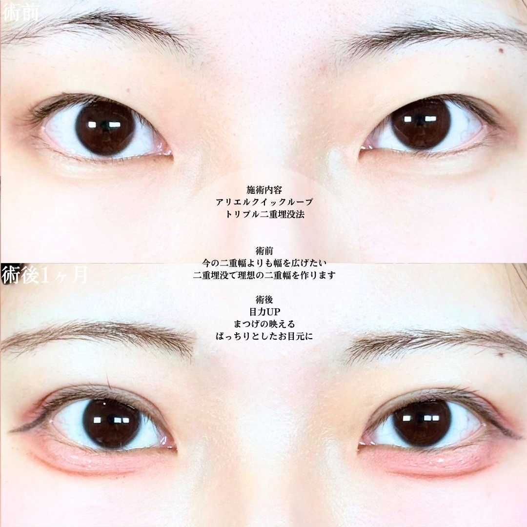 No.19597の症例写真1