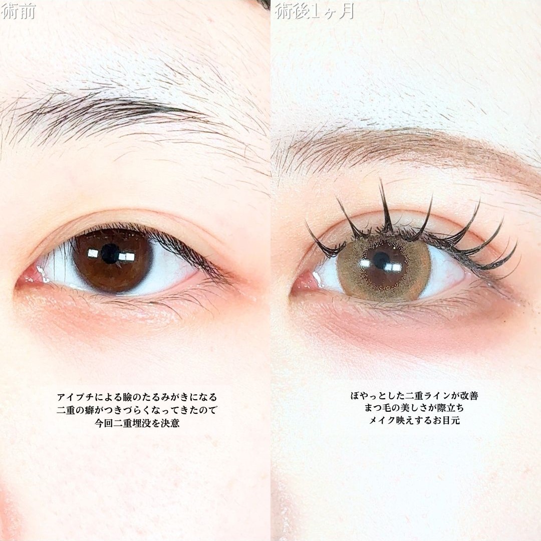 No.19667の症例写真1