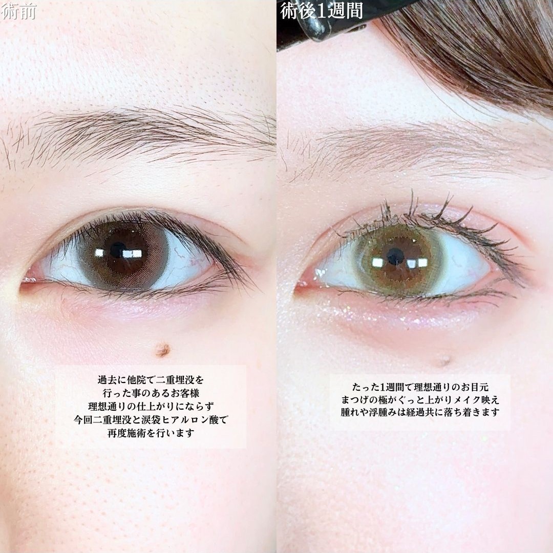 No.19728の症例写真1